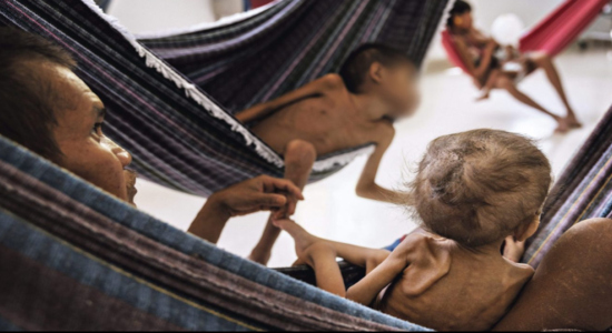 Niños yanomami en estado de desnutrición